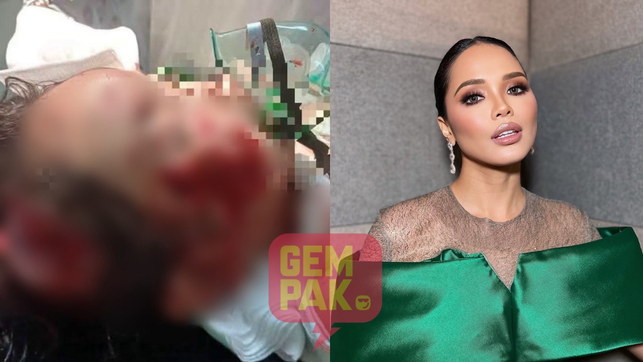 Ain Edruce Ungkap: Aku Ajarkan Anak Jauhi dan Takut Anjing Liar Jadi Sorotan